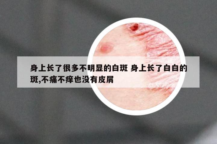 身上长了很多不明显的白斑 身上长了白白的斑,不痛不痒也没有皮屑