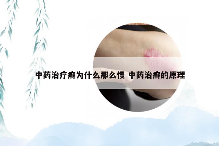 中药治疗癣为什么那么慢 中药治癣的原理