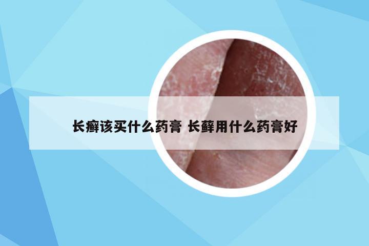 长癣该买什么药膏 长藓用什么药膏好