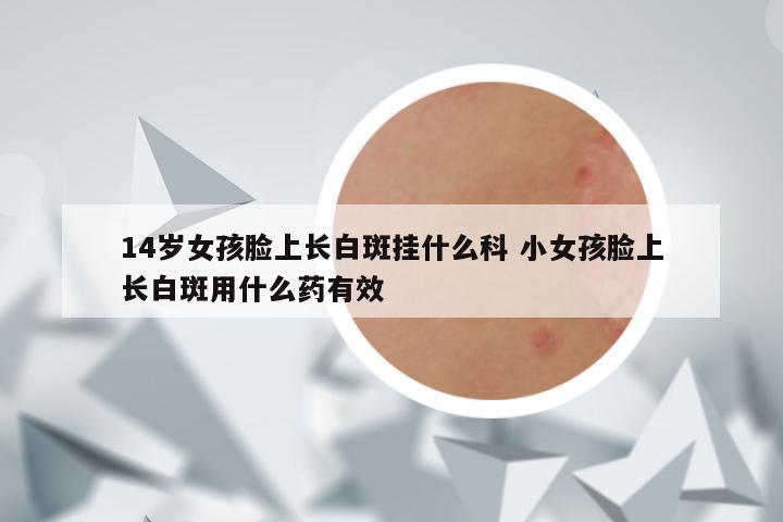 14岁女孩脸上长白斑挂什么科 小女孩脸上长白斑用什么药有效