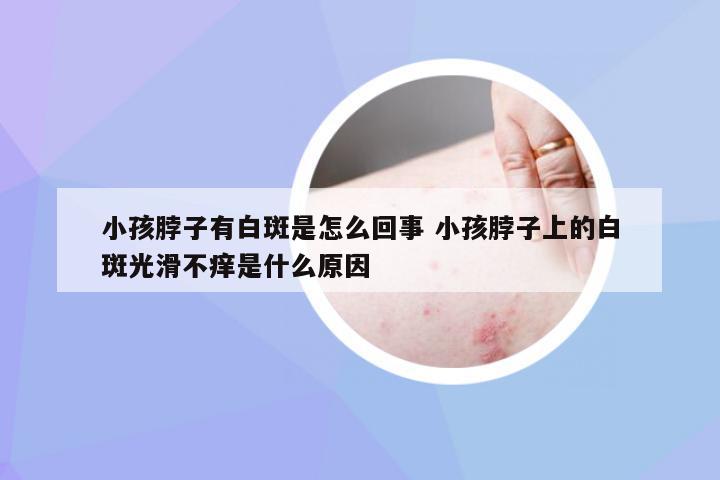 小孩脖子有白斑是怎么回事 小孩脖子上的白斑光滑不痒是什么原因