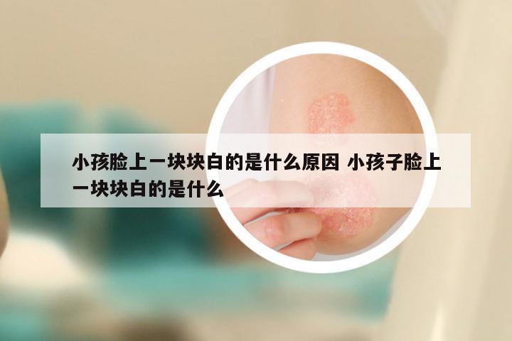 小孩脸上一块块白的是什么原因 小孩子脸上一块块白的是什么