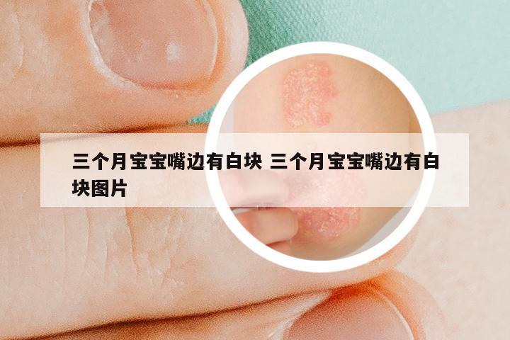 三个月宝宝嘴边有白块 三个月宝宝嘴边有白块图片