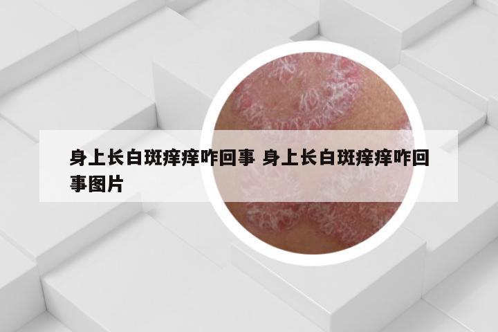 身上长白斑痒痒咋回事 身上长白斑痒痒咋回事图片