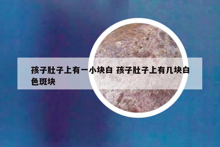 孩子肚子上有一小块白 孩子肚子上有几块白色斑块