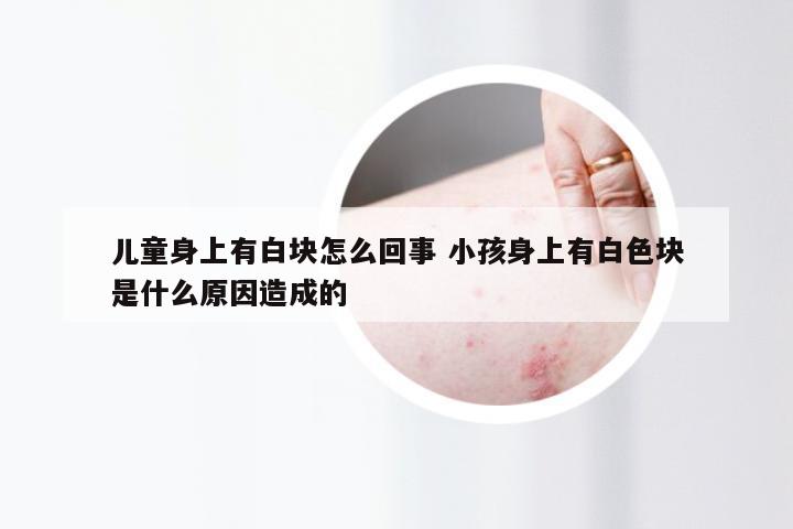 儿童身上有白块怎么回事 小孩身上有白色块是什么原因造成的