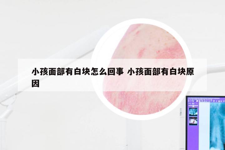 小孩面部有白块怎么回事 小孩面部有白块原因