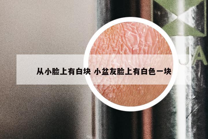 从小脸上有白块 小盆友脸上有白色一块
