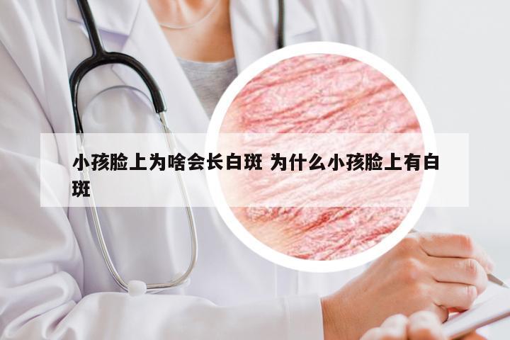 小孩脸上为啥会长白斑 为什么小孩脸上有白斑