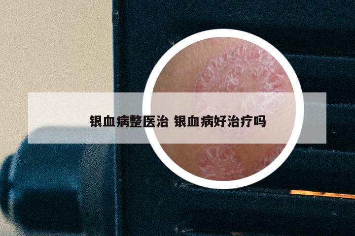 银血病整医治 银血病好治疗吗
