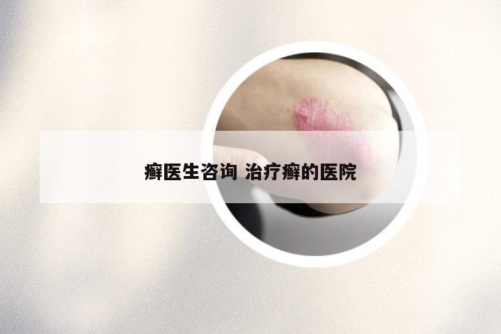癣医生咨询 治疗癣的医院