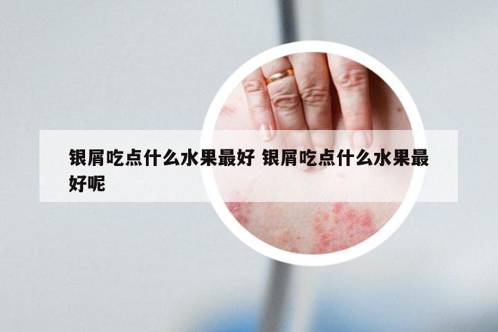 银屑吃点什么水果最好 银屑吃点什么水果最好呢