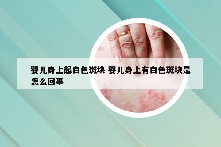 婴儿身上起白色斑块 婴儿身上有白色斑块是怎么回事