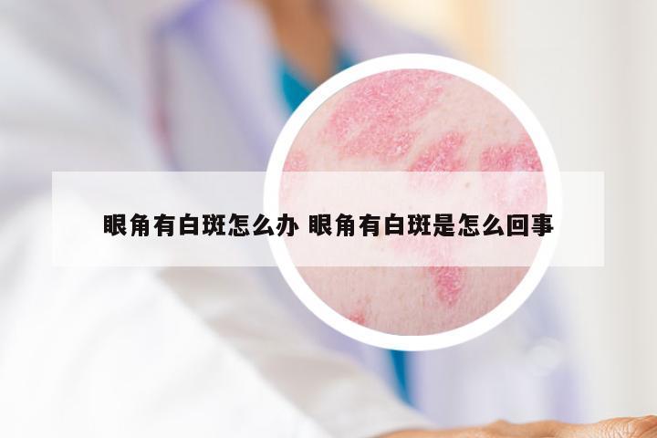 眼角有白斑怎么办 眼角有白斑是怎么回事