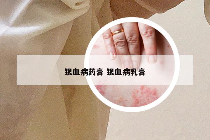 银血病药膏 银血病乳膏