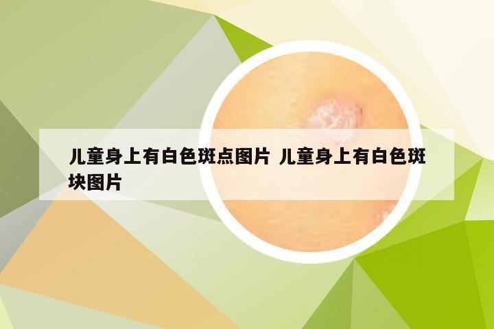 儿童身上有白色斑点图片 儿童身上有白色斑块图片