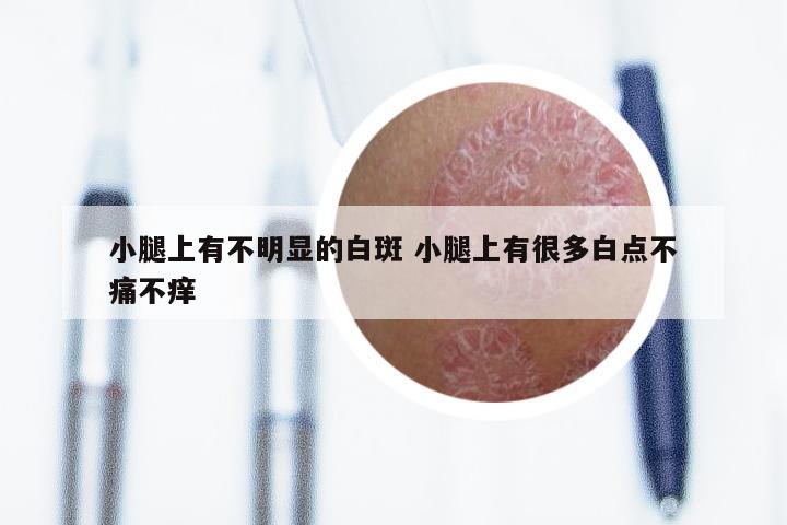 小腿上有不明显的白斑 小腿上有很多白点不痛不痒
