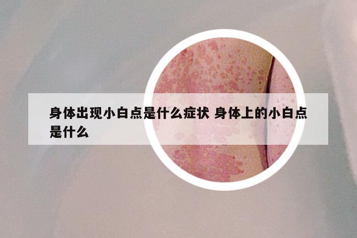 身体出现小白点是什么症状 身体上的小白点是什么