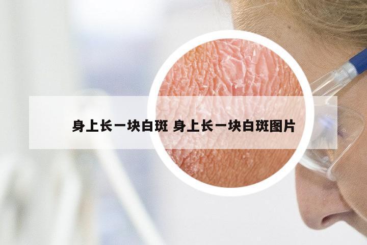 身上长一块白斑 身上长一块白斑图片