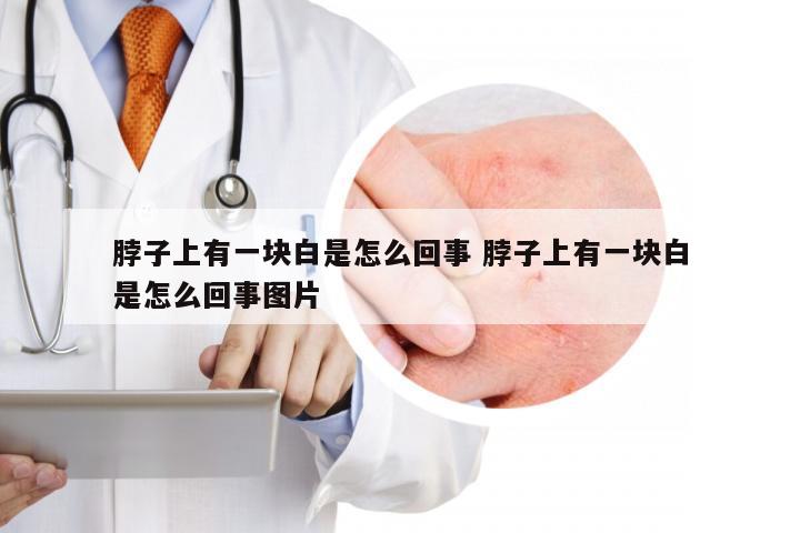 脖子上有一块白是怎么回事 脖子上有一块白是怎么回事图片