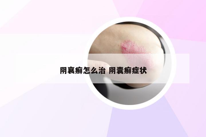 阴襄癣怎么治 阴囊癣症状