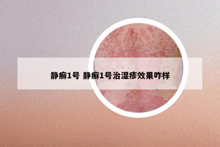 静癣1号 静癣1号治湿疹效果咋样