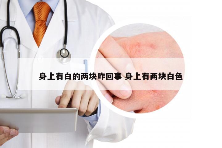 身上有白的两块咋回事 身上有两块白色