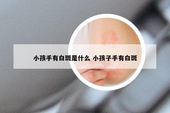 小孩手有白斑是什么 小孩子手有白斑