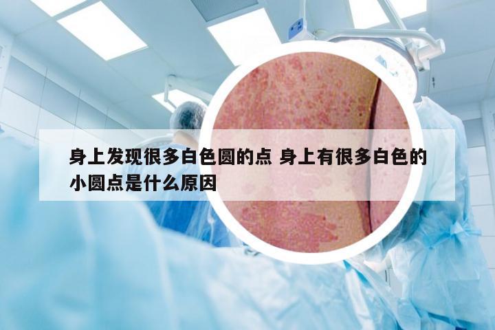 身上发现很多白色圆的点 身上有很多白色的小圆点是什么原因