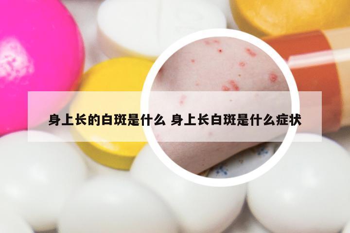 身上长的白斑是什么 身上长白斑是什么症状