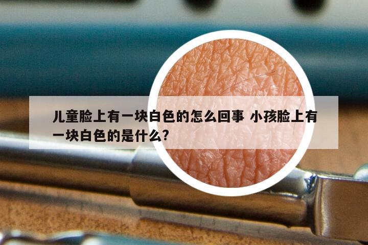 儿童脸上有一块白色的怎么回事 小孩脸上有一块白色的是什么?