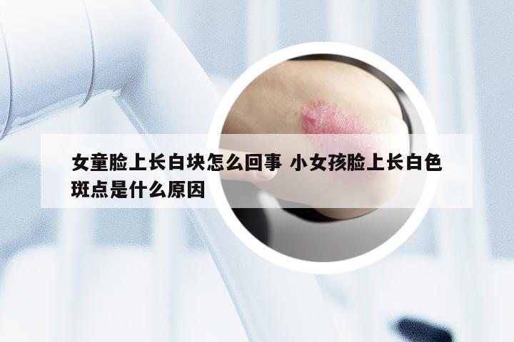 女童脸上长白块怎么回事 小女孩脸上长白色斑点是什么原因