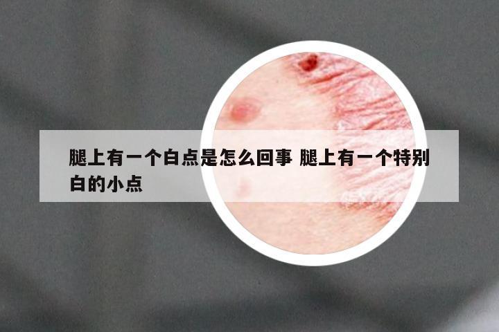 腿上有一个白点是怎么回事 腿上有一个特别白的小点