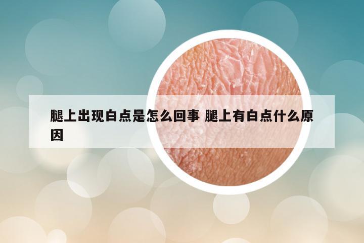 腿上出现白点是怎么回事 腿上有白点什么原因