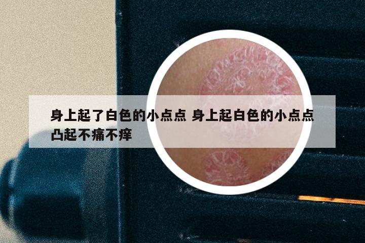 身上起了白色的小点点 身上起白色的小点点凸起不痛不痒