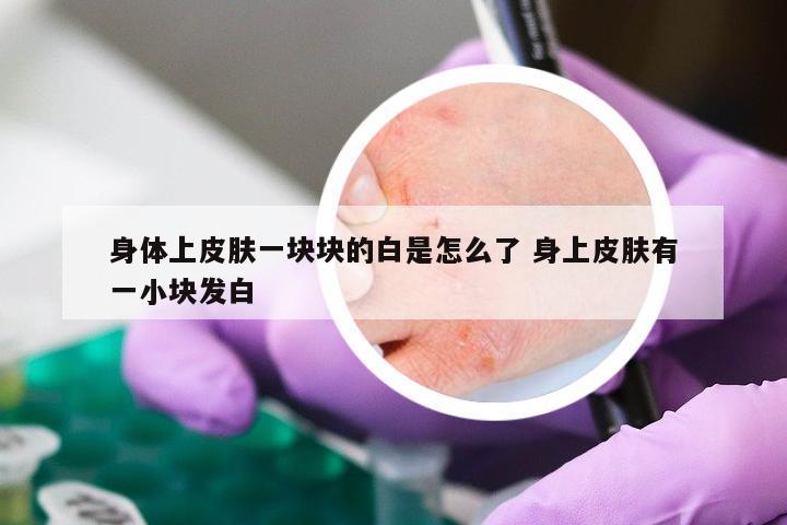 身体上皮肤一块块的白是怎么了 身上皮肤有一小块发白