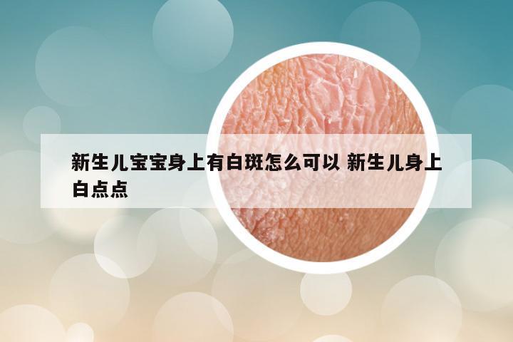 新生儿宝宝身上有白斑怎么可以 新生儿身上白点点
