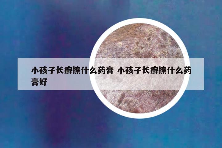 小孩子长癣擦什么药膏 小孩子长癣擦什么药膏好