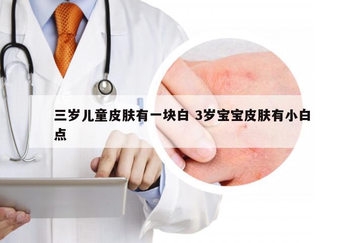 三岁儿童皮肤有一块白 3岁宝宝皮肤有小白点