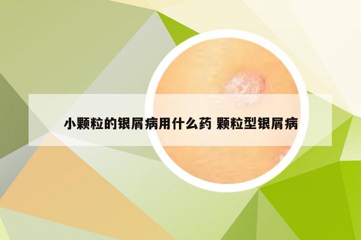 小颗粒的银屑病用什么药 颗粒型银屑病