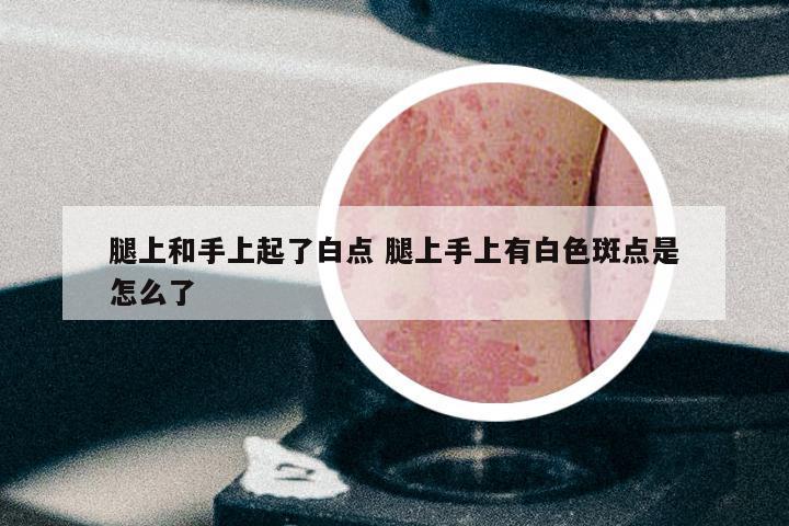 腿上和手上起了白点 腿上手上有白色斑点是怎么了