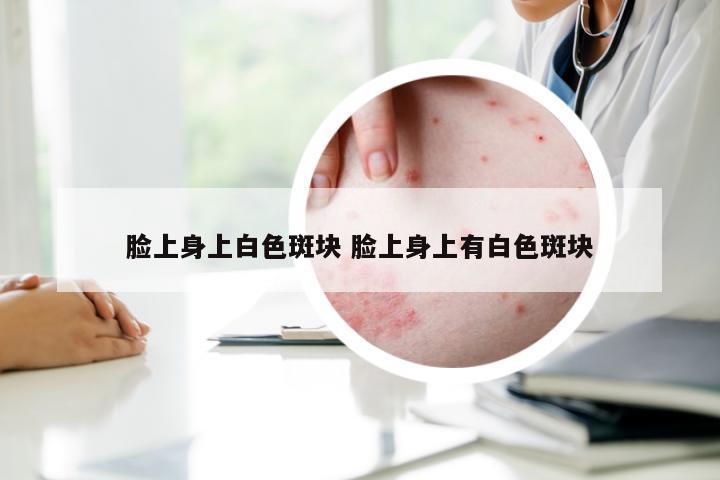 脸上身上白色斑块 脸上身上有白色斑块