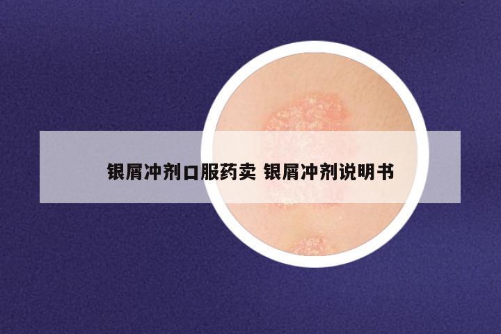 银屑冲剂口服药卖 银屑冲剂说明书