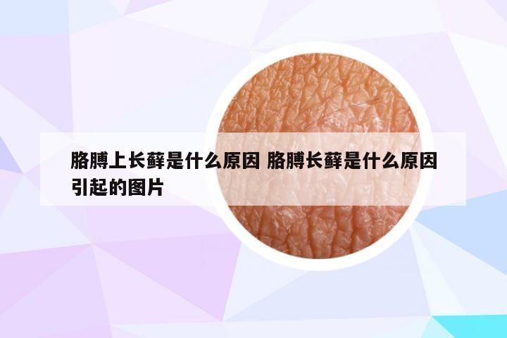 胳膊上长藓是什么原因 胳膊长藓是什么原因引起的图片