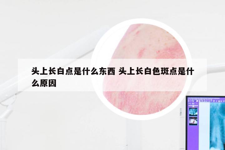 头上长白点是什么东西 头上长白色斑点是什么原因