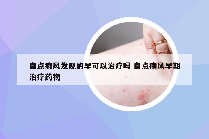 白点癫风发现的早可以治疗吗 白点癫风早期治疗药物