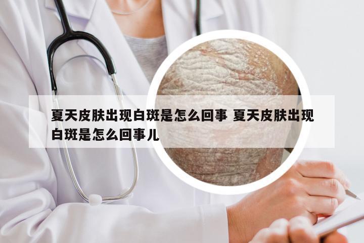 夏天皮肤出现白斑是怎么回事 夏天皮肤出现白斑是怎么回事儿