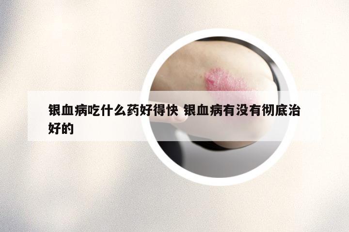 银血病吃什么药好得快 银血病有没有彻底治好的