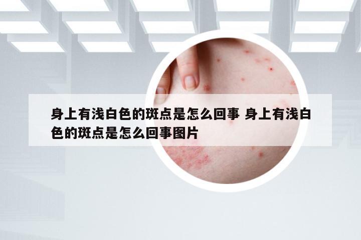 身上有浅白色的斑点是怎么回事 身上有浅白色的斑点是怎么回事图片
