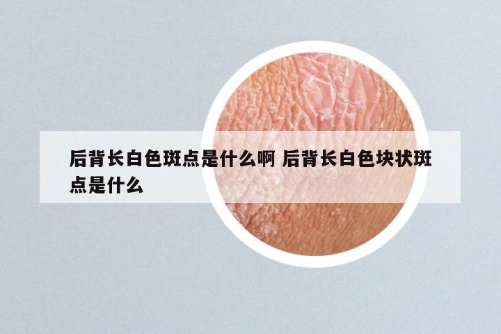 后背长白色斑点是什么啊 后背长白色块状斑点是什么